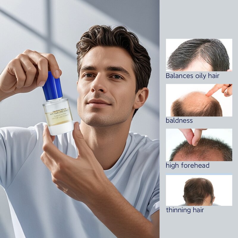 Anti-hair Loss Set Manufacturer - Wholesale Nattiguard with Keratin & Adenosine Oil Control for Man