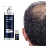 Shampoo Manufacturer - Private Label Anti Hair Loss Scalp Treatment for Men Thickening