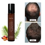 Hair Growth Serum Manufacturer - DHT Blocking Scalp Serum with Rosemary Roll on