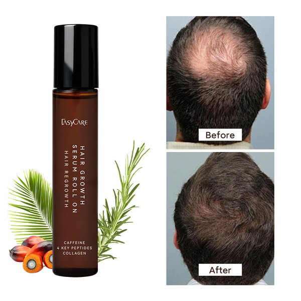 Hair Growth Serum Manufacturer - DHT Blocking Scalp Serum with Rosemary Roll on