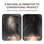 Hair Growth Serum Manufacturer - Private Label 15ml Rosemary Roll on for Scalp Strengthening Regrowth