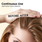 Hair Loss Treatment Serum Manufacturer - Zealmore with Ginseng Nourishing Hydrating Coffee