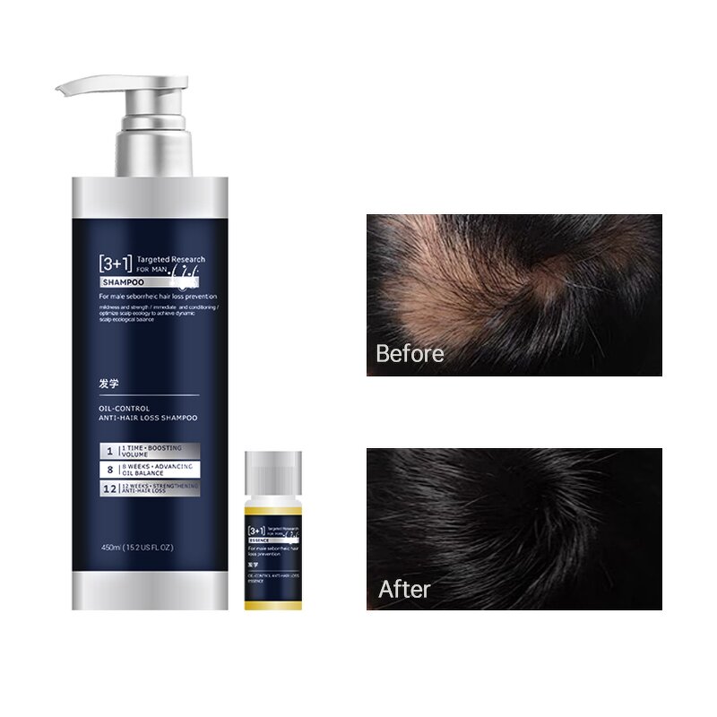 Shampoo Manufacturer - Private Label Anti Hair Loss Scalp Treatment for Men Thickening