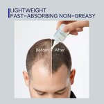 Anti-hair Loss Set Manufacturer - Wholesale Nattiguard with Keratin & Adenosine Oil Control for Man