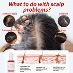 Hair Serum Manufacturer - OEM Natural Green Ginger Scalp Repair Boost Growth Oil Loss Recovery Herbal