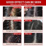 Hair Serum Manufacturer - OEM Natural Green Ginger Scalp Repair Boost Growth Oil Loss Recovery Herbal