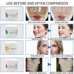 Face Mask Manufacturer - Collagen-Based Anti-Acne White Mud Mask Aloe Soothing Repair Oil Control Acne Removal