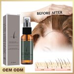 Hair Care Essential Oil Manufacturer - Wholesale 60ml Rosemary 100% Plant for Growth Strengthening