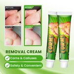 Foot Corn Cream - OEM 30G Chicken Eye Dead Skin Calluses Treatment Cream