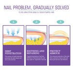 Gray Nail Spray - OEM 100ml Plant Extract Fungus Nail Care Odor Clean