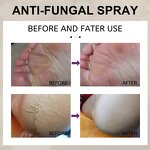 Foot Spray Factory - Moisturize Exfoliate Anti-itch Deodorant Nail Care