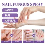Gray Nail Spray - OEM 100ml Plant Extract Fungus Nail Care Odor Clean