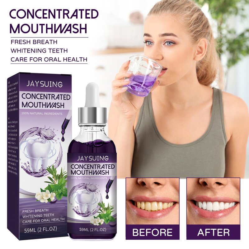Concentrated Mouthwash - OEM Fresh Breath Stain Remove Gingival Pain Antiseptic
