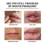 Aloe Vera Lip Balm - OEM EELHOE 4.7G Long Lasting Nourishing Moisturizing