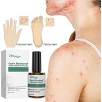 Skin Tag Wart Cream - OEM Herbal Extract Flesh Thorn Corn Removal Wholesale
