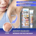 Dark Spot Cream - OEM 20G Intimate Area Body Whitening Spot Removal