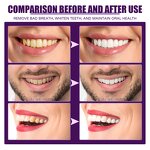 Concentrated Mouthwash - OEM Fresh Breath Stain Remove Gingival Pain Antiseptic