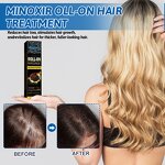 Hair Growth Cream - OEM Roll-on Ginger Sesame Oil Thinning Hair Regrowth