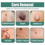 Skin Tag Wart Cream - OEM Herbal Extract Flesh Thorn Corn Removal Wholesale