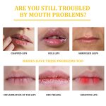 Lip Balm Factory - 10g Fade Lip Line Anti-Crack Moisturizing Anti Freeze