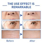 Peptide Serum - OEM Anti-Wrinkle Firming Lifting Dark Spot Erase Hydroconus