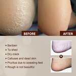 Foot Spray Factory - Moisturize Exfoliate Anti-itch Deodorant Nail Care