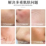 水氧面部仪供应商-喷射去角质钻石氧17合1