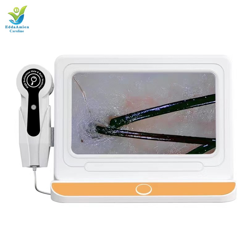 Hair Analysis Machine Supplier - HD 5 In1 AI Tester