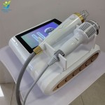 RF胶原蛋白仪供应商-妊娠纹去除