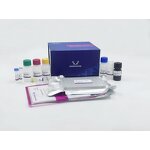 Pinp ELISA Kit - Rat Procollagen I N-Terminal Propeptide Research Use