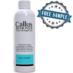 Foot Callus Remover Gel - Manufacturer - OEM ODM Professional Exfoliator Dead Skin Eliminator
