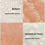 Ingrown Hair Treatment Spray - Manufacturer - Private Label Prevent Razor Bumps Soothe Irritation After Waxing