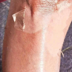 Peeling Oil - Factory - OEM Private Label Extra Strong Whitening Yellow Peeling