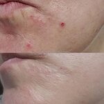 Medlar Rose Essential Oil - Manufacturer - Private Label Anti-Wrinkle Anti-Aging Acne-Fighting Vitamin E