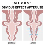 Vaginal Tightening Gel - Manufacturer - Private Label Gynecological Firming Shrink Cream