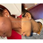 Medlar Rose Essential Oil - Manufacturer - Private Label Anti-Wrinkle Anti-Aging Acne-Fighting Vitamin E