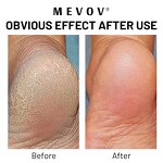 Urea Foot Cream - Factory - Private Label Moisturizing Dry Skin Anti Fungal Natural Callus Remover