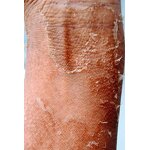 Peeling Oil - Factory - OEM Private Label Extra Strong Whitening Yellow Peeling