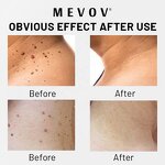 Warts Remover Cream - Manufacturer - Private Label Skin Tag Wart Callus Remove Scar Free Herbal