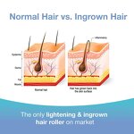 Dark Spot Remover Roll on - Manufacturer - Private Label Ingrown Hair Razor Bump Stopper