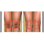 Peeling Oil - Factory - OEM Private Label Extra Strong Whitening Yellow Peeling