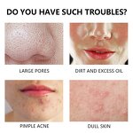 Acne Skin Care Set - Factory - ODM OEM Benzoyl Peroxide Cleanser Toner Serum Whitening