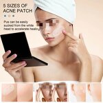 Acne Patch Manufacturer - Wholesale Private Label Waterproof Hydrocolloid