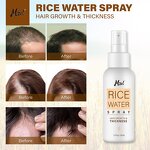 Hair Growth Spray Manufacturer - with Rice Water & Rosemary Oil for Hair Loss
