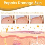 Bee Venom Spray Manufacturer - Wholesale High Quality Natural Tag Recede