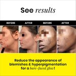 Clay Face Mask Manufacturer - OEM Private Label Vegan with Turmeric & Vitamin C