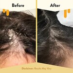 Scalp Oil Manufacturer - Honey Infused Natural for Itchy Scalp Relief