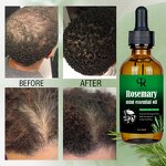 Rosemary Hair Growth Oil - Manufacturer - 100% Natural Nourishing Scalp Elixir Hair Loss Treatment