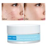 Salicylic Acid Peeling Mask - Manufacturer - OEM AHA Exfoliating Blackhead Removal Anti Acne Mask