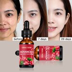 Alpha Arbutin Serum - Manufacturer - Wholesale 2% Lightening Remove Dark Spots Facial Serum
